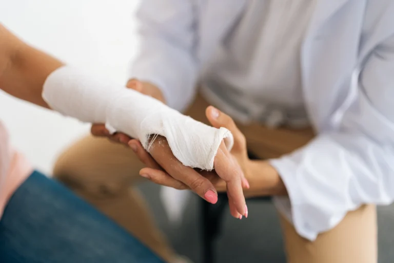 injured hand in a cast